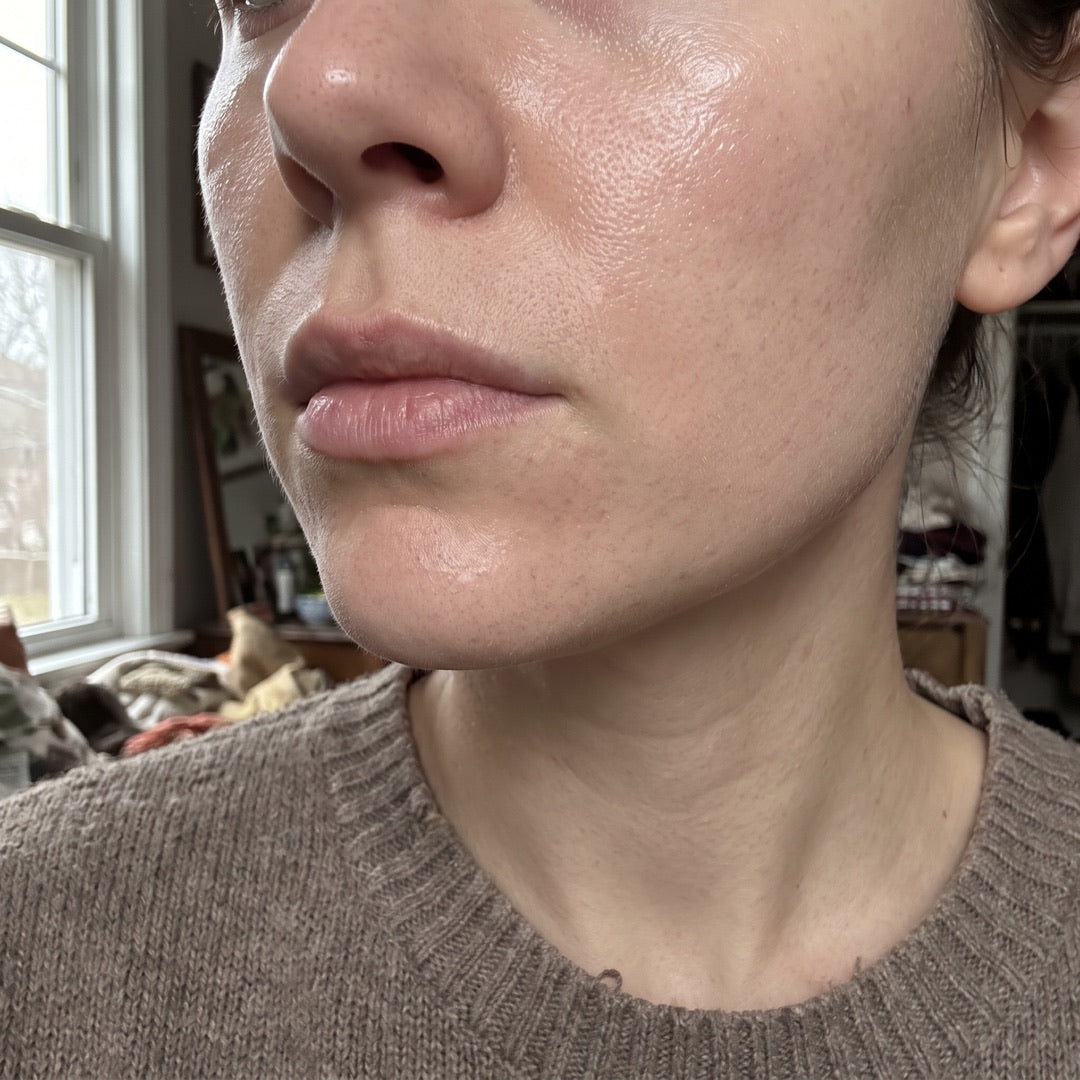 Close-up of hydrated, glowing skin in natural light